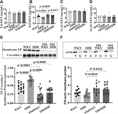 Thromboxane-induced contractile response of mesenteric arterioles is diminished in the older rats and the older hypertensive rats